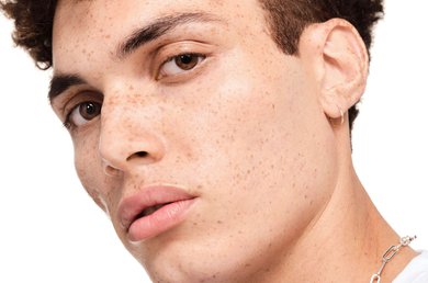 acne-and-stress-tips-for-keeping-calm-and-taking-control