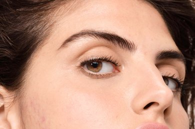 what-is-hormonal-acne-and-how-can-a-skincare-routine-help