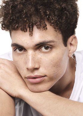 winter-acne-how-to-manage-imperfection-prone-dry-skin