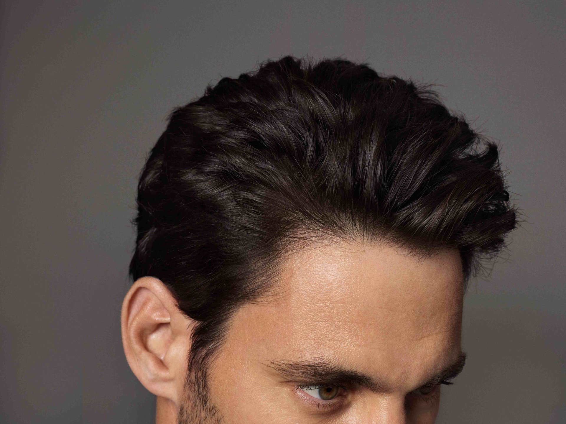 stages-of-hair-loss-how-to-act-fast